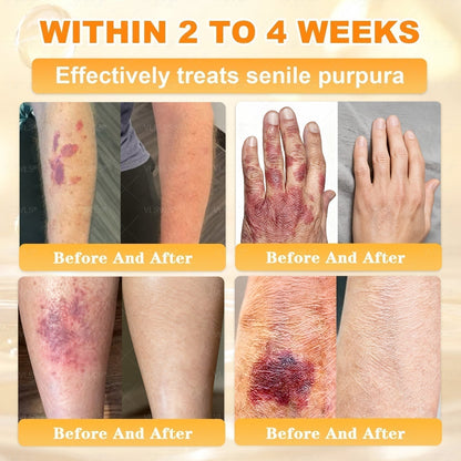 🔥 LAST DAY 80% OFF🔥 Aeehfeng® Bee Venom Skin Restoration Cream