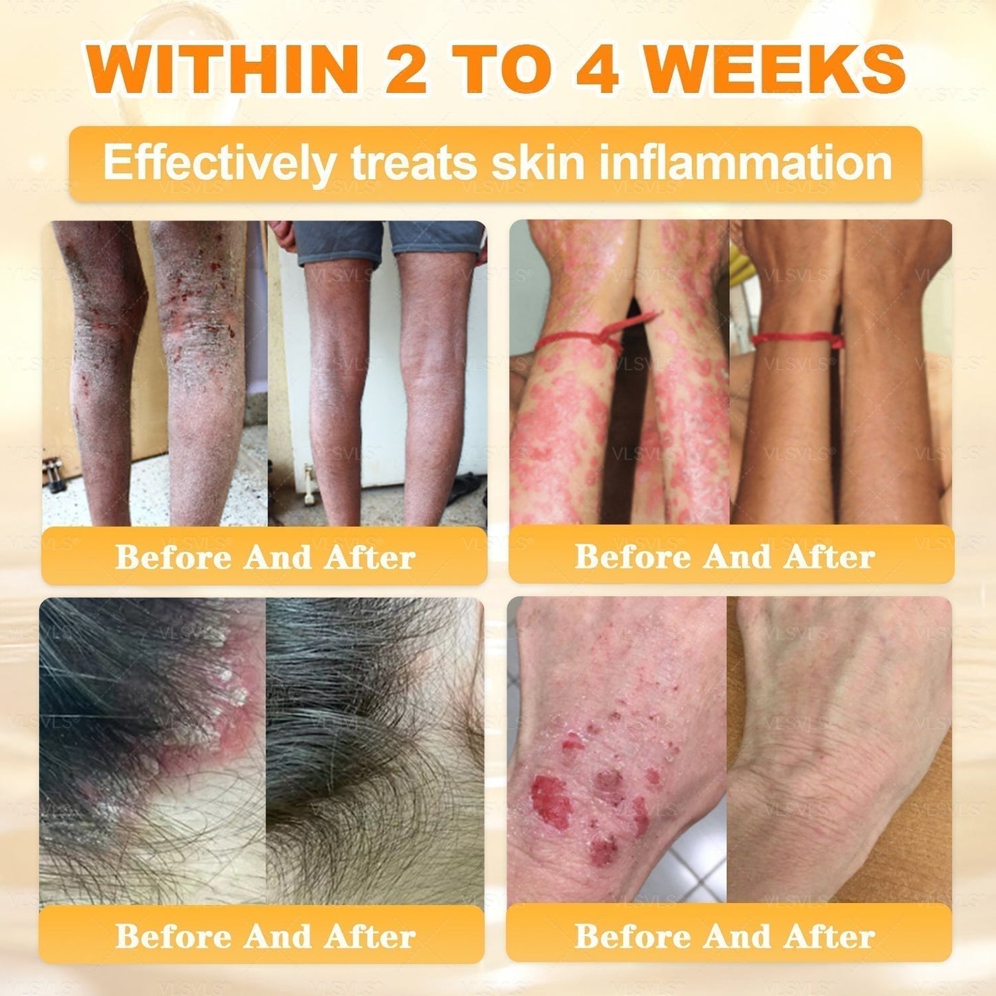 🔥 LAST DAY 80% OFF🔥 Aeehfeng® Bee Venom Skin Restoration Cream